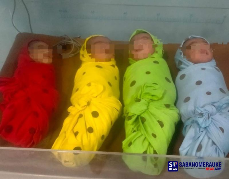 Wow! Seorang Ibu di Kuantan Singingi Lahirkan 4 Bayi Kembar Sekaligus